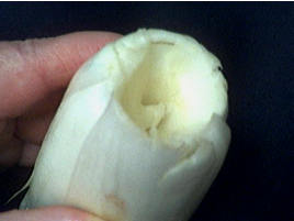 endive